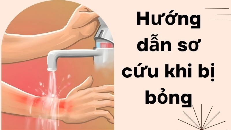 Phân loại mức độ tổn thương da khi bị bỏng