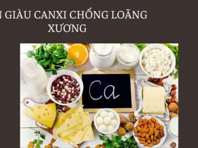 Phòng ngừa loãng xương từ sớm giúp xương chắc khỏe dẻo dai
